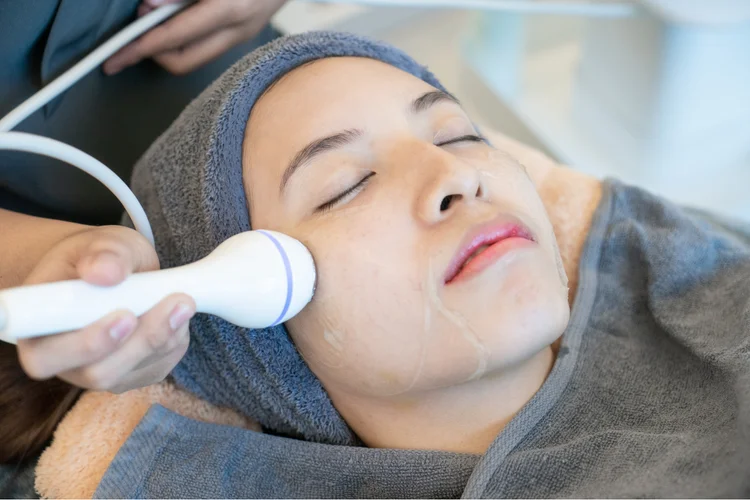 Asian woman getting chemical peel treatment demonstrating acne management with combined therapies.